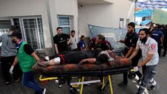 An injured Palestinian woman is wheeled into the al-Shifa hospital, following Israeli airstrikes on Gaza City, central Gaza Strip, Sunday, Nov. 5, 2023.AP Photo/Abed Khaled