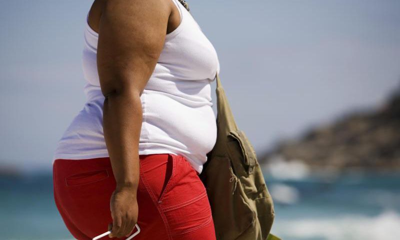 An obese woman