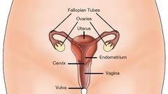 Cervical cancer