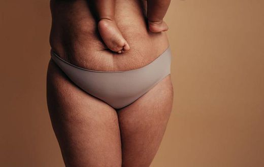Belly wrapping can be a valuable part of your postpartum recovery [Parents]