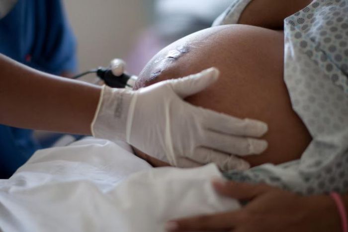 File photo of an expectant woman in hospital
