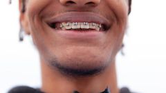 A person with braces