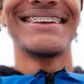 A person with braces