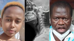 A collage photo of Rita Waeni, an X-ray  photo and Government Pathologist Johansen Oduor