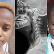 A collage photo of Rita Waeni, an X-ray  photo and Government Pathologist Johansen Oduor