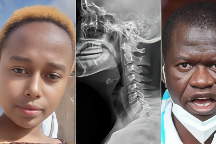 A collage photo of Rita Waeni, an X-ray  photo and Government Pathologist Johansen Oduor