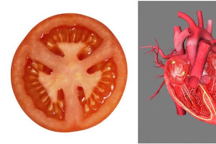 tomatoes  [Healthista]