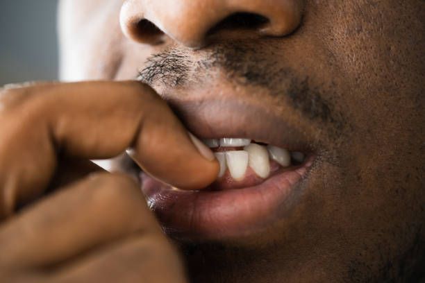 Other causes of nail biting